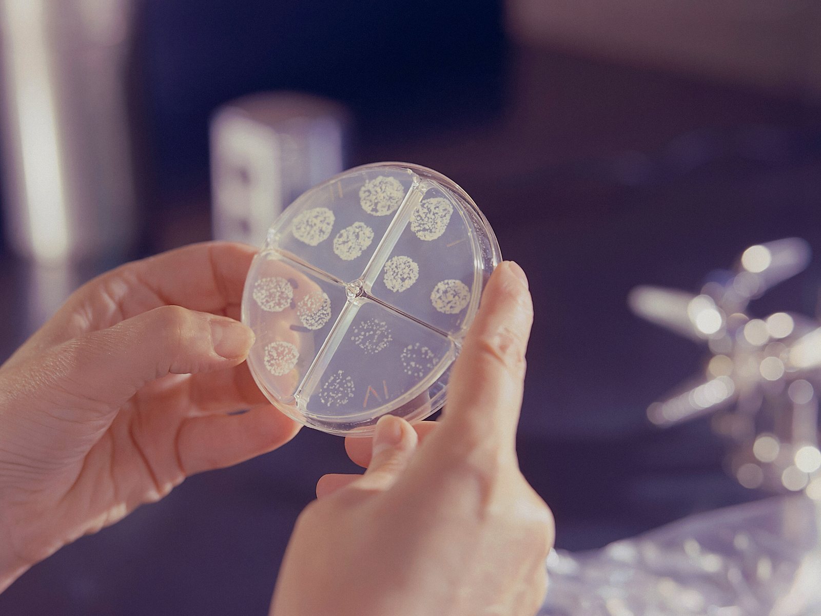Campionamento microbiologico analizzato da laboratorio accreditato — Rentacs, Service Key Group Piastra di coltura a quattro settori con colonie microbiche, esito di un campionamento su impianto aeraulico analizzato da laboratorio accreditato ACCREDIA
